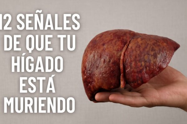 Síntomas de un hígado enfermo: descubre 12 señales y un tratamiento casero efectivo