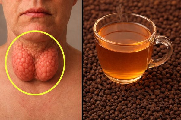 6 pasos sencillos para apoyar la salud de la tiroides de forma natural